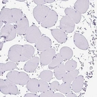 Immunohistochemical staining of human skeletal muscle shows no positivity in myocytes.