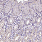 Immunohistochemical staining of human stomach shows low positivity in glandular cells as expected.