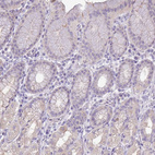 Anti-PNLDC1 Antibody