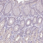 Immunohistochemical staining of human stomach shows low positivity in glandular cells as expected.