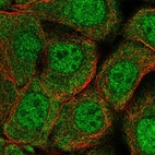 Immunofluorescent staining of human cell line MCF7 shows localization to nucleoplasm & cytosol.
