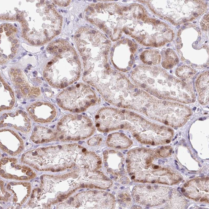 Anti-ZNF354A Antibody