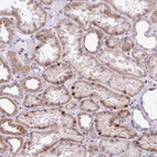 Anti-ZNF354A Antibody