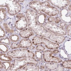Anti-ZNF354A Antibody
