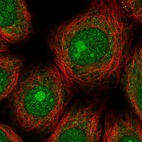 Immunofluorescent staining of human cell line MCF7 shows localization to nucleus, nucleoli & cytosol.