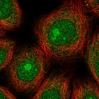 Immunofluorescent staining of human cell line MCF7 shows localization to nucleus, nucleoli & cytosol.