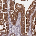 Immunohistochemical staining of human small intestine shows strong membranous positivity in glandular cells.