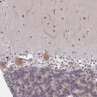 Immunohistochemical staining of human cerebellum shows moderate cytoplasmic positivity in Purkinje cells.