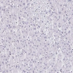 Immunohistochemical staining of human liver shows no positivity in hepatocytes as expected.