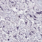 Immunohistochemical staining of human placenta shows no positivity in trophoblastic cells as expected.