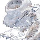 Immunohistochemical staining of mouse embryo E14 shows strong cytoplasmic positivity in neuronal cells.