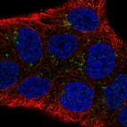 Immunofluorescent staining of human cell line RT4 shows localization to vesicles.