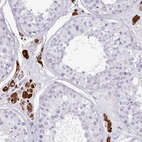 Anti-SLC35G2 Antibody