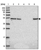 Lane 1: Marker [kDa] 250, 130, 95, 72, 55, 36, 28, 17, 10_br/_Lane 2: Human cell line RT-4_br/_Lane 3: Human cell line U-251 MG_br/_Lane 4: Human plasma_br/_Lane 5: Human Liver tissue_br/_Lane 6: Human Tonsil tissue