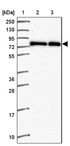 Lane 1: Marker [kDa] 250, 130, 95, 72, 55, 36, 28, 17, 10_br/_Lane 2: Human cell line RT-4_br/_Lane 3: Human cell line U-251MG sp