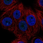 Immunofluorescent staining of human cell line MCF7 shows localization to nuclear bodies.