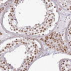 Immunohistochemical staining of human testis shows high expression.