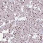 Immunohistochemical staining of human pancreas shows low expression as expected.