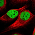 Immunofluorescent staining of human cell line U-2 OS shows localization to nucleoplasm.