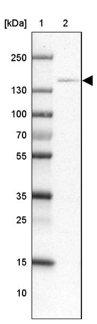 Lane 1: Marker [kDa] 250, 130, 100, 70, 55, 35, 25, 15, 10_br/_Lane 2: Human cell line NTERA-2