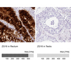 Anti-ZG16 Antibody