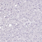 Immunohistochemical staining of human liver shows no positivity in hepatocytes as expected.