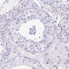 Immunohistochemical staining of human testis shows no positivity in cells in seminiferous ducts as expected.