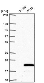 Anti-ZG16 Antibody