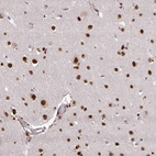 Anti-U2AF1 Antibody