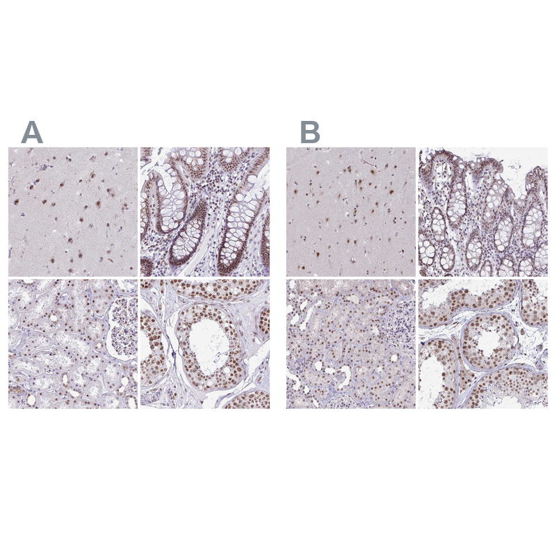 Anti-PUF60 Antibody