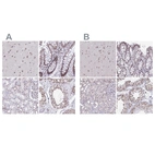 Anti-PUF60 Antibody
