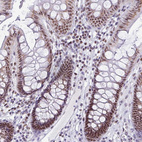 Immunohistochemical staining of human colon shows strong nuclear positivity in glandular cells.