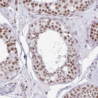 Immunohistochemical staining of human testis shows strong nuclear positivity in cells in seminiferous ducts.