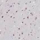 Immunohistochemical staining of human cerebral cortex shows strong nuclear positivity in neurons.