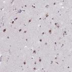 Immunohistochemical staining of human cerebral cortex shows strong nuclear positivity in neurons.