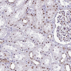 Immunohistochemical staining of human kidney shows strong nuclear positivity in cells in tubules.