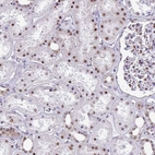 Immunohistochemical staining of human kidney shows strong nuclear positivity in cells in tubules.