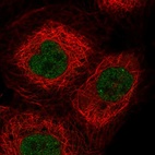 Immunofluorescent staining of human cell line A-431 shows localization to nucleoplasm.