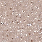 Immunohistochemical staining of human cerebral cortex shows high expression.