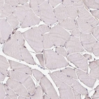 Immunohistochemical staining of human skeletal muscle shows low expression as expected.