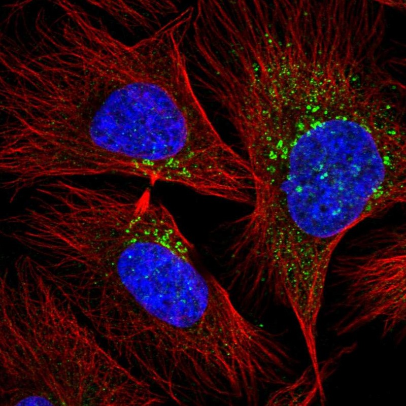 Anti-RAB20 Antibody