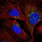 Anti-RAB20 Antibody