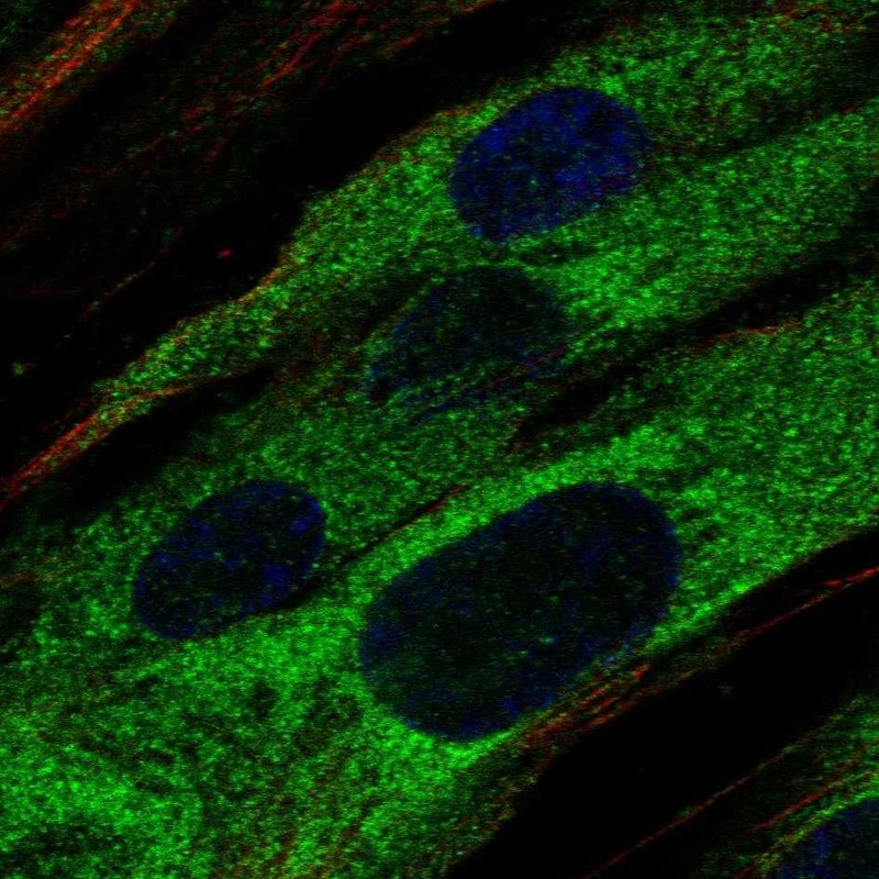 Anti-ABCA9 Antibody