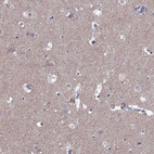 Anti-ASIC2 Antibody
