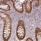Anti-TMEM8B Antibody