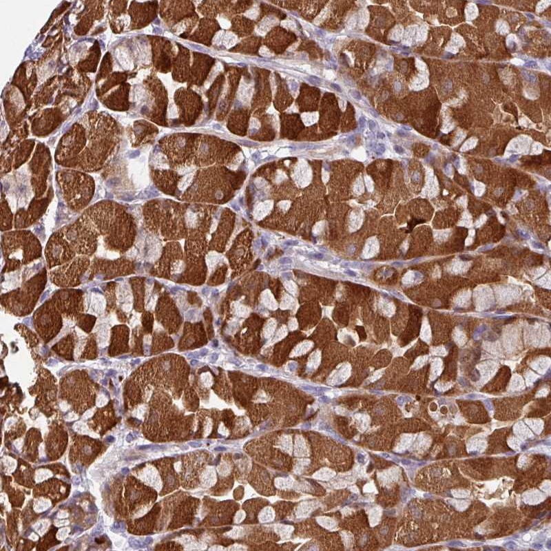Anti-C2orf16 Antibody