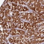Anti-C2orf16 Antibody