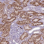 Anti-MGAT4B Antibody