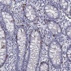 Immunohistochemical staining of human small intestine shows high expression.