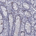Immunohistochemical staining of human small intestine shows high expression.